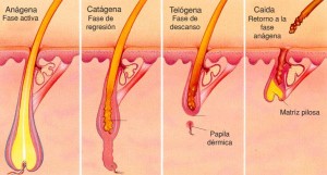 fototermolisis-selectiva-castellano